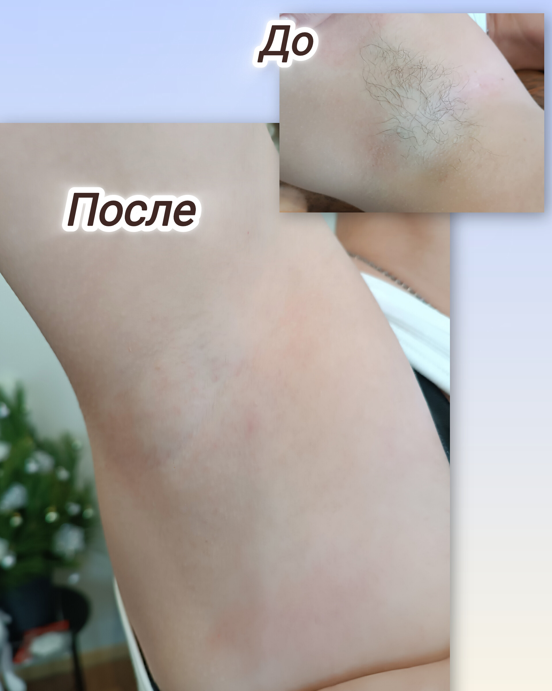 Шугарінг рук